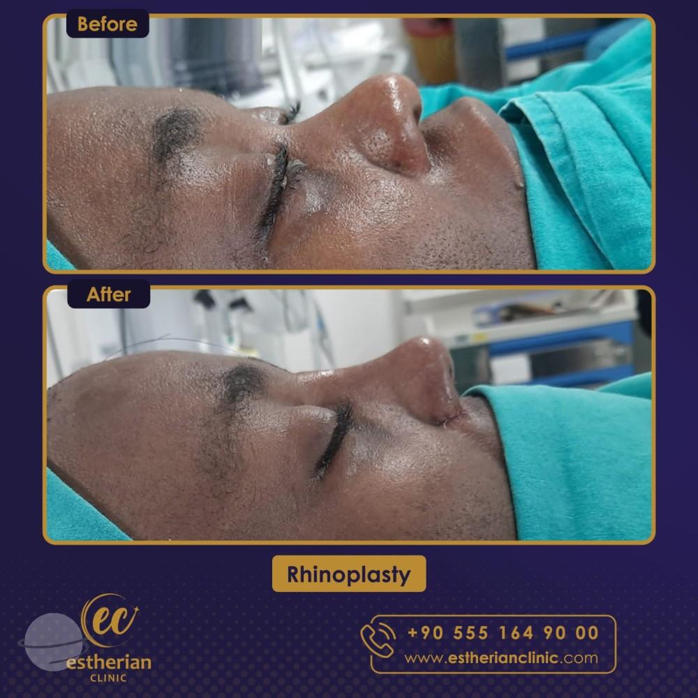 Estherian Istanbul on Esthetic Planet