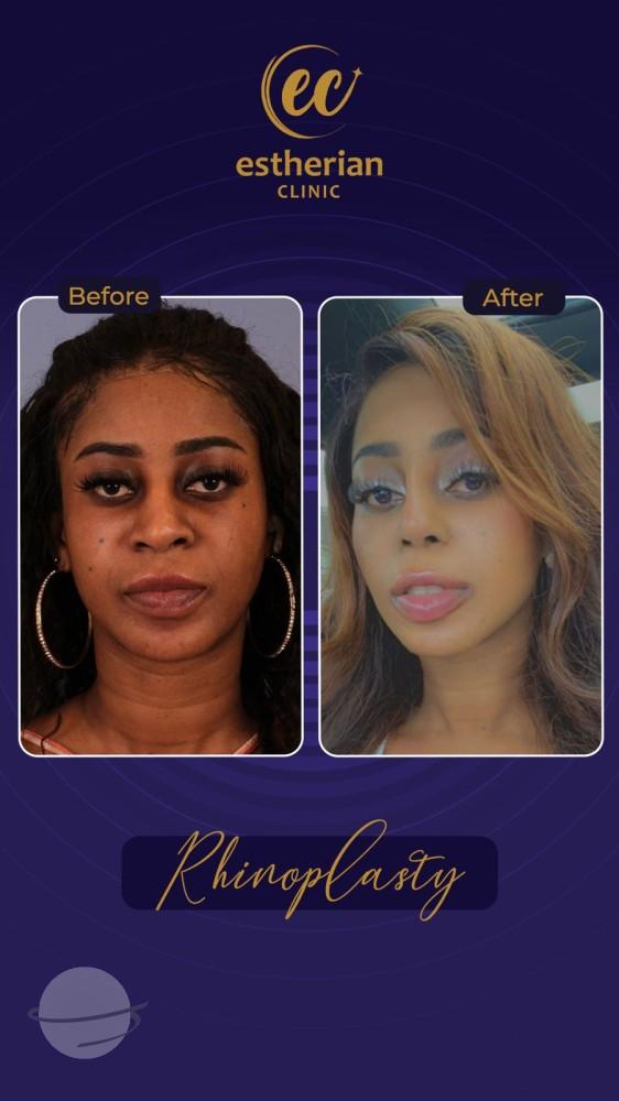 Estherian Istanbul on Esthetic Planet