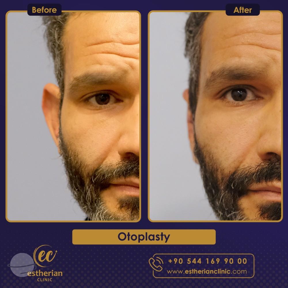 Estherian Istanbul on Esthetic Planet