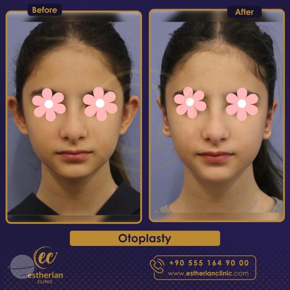 Estherian Istanbul on Esthetic Planet