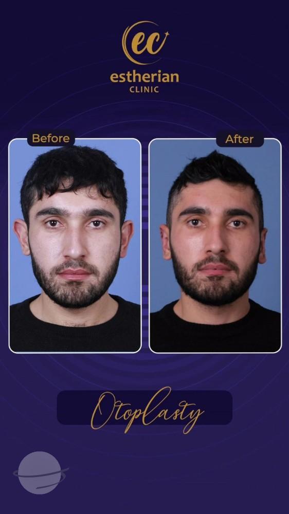 Estherian Istanbul on Esthetic Planet