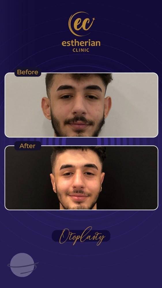 Estherian Istanbul on Esthetic Planet