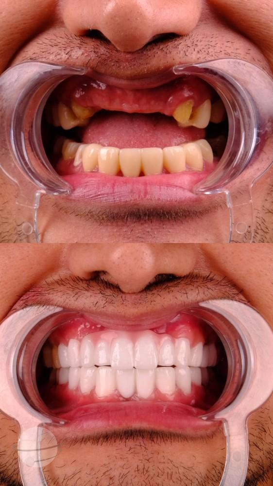 Estherian Istanbul on Esthetic Planet