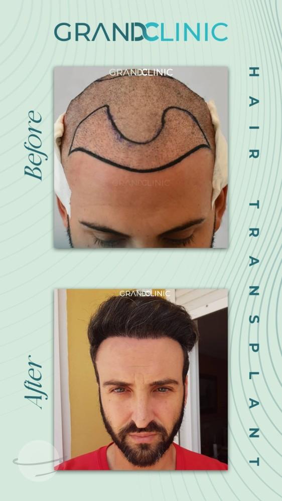 219d14f5-1c92-4a56-94ad-4914d96bed9d