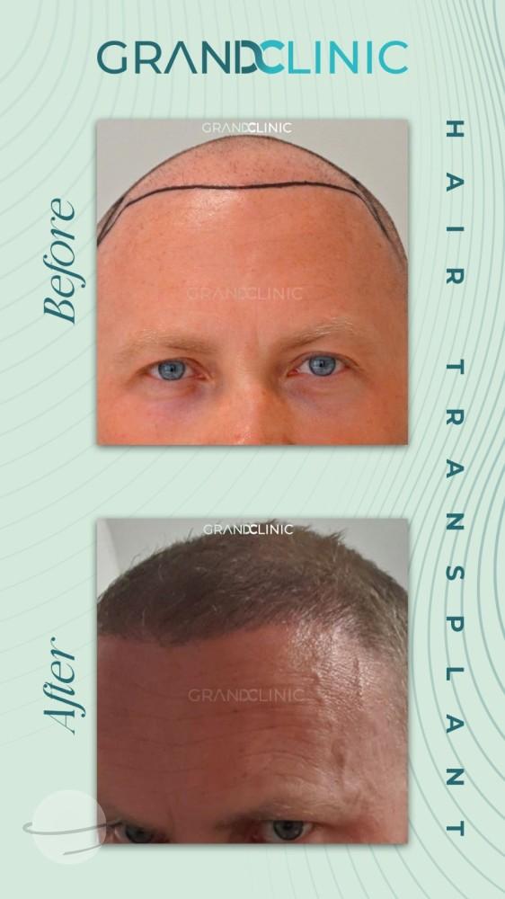 bbaff625-f756-41a0-910e-8493f3139936