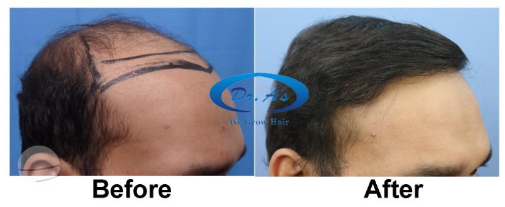 A comparison picture 305_07