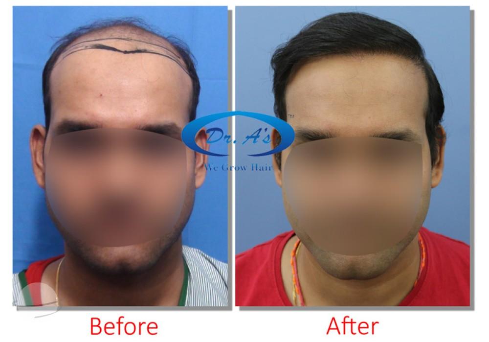 A comparison picture03_21