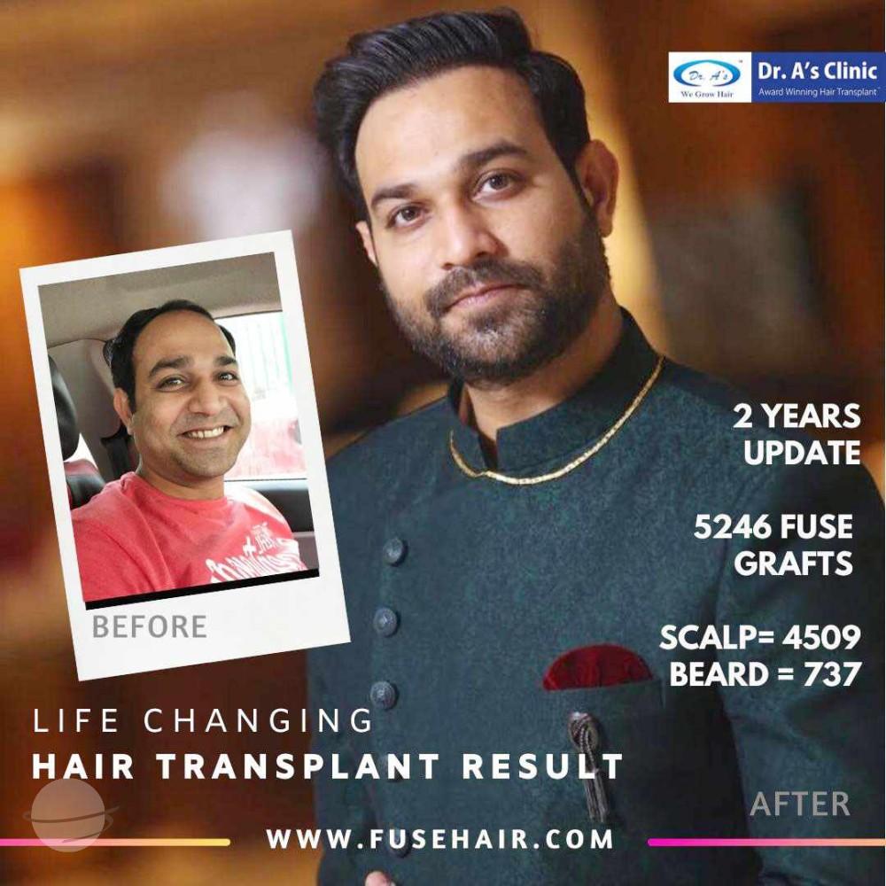 A comparison picture 138_02