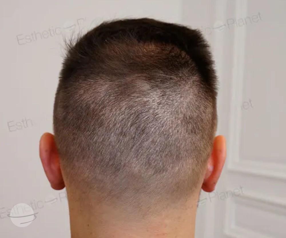 3800 FUE DR BEYHAN DONOR AREA