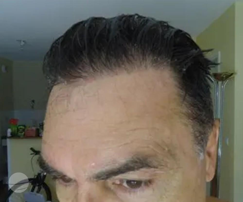 3800 FUE DR BEYHAN FRONT VIEW4