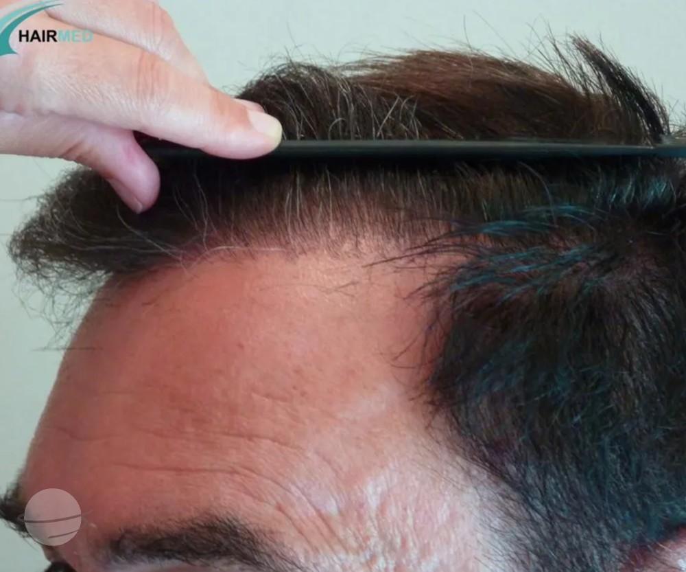 3800 FUE DR BEYHAN FRONT VIEW3