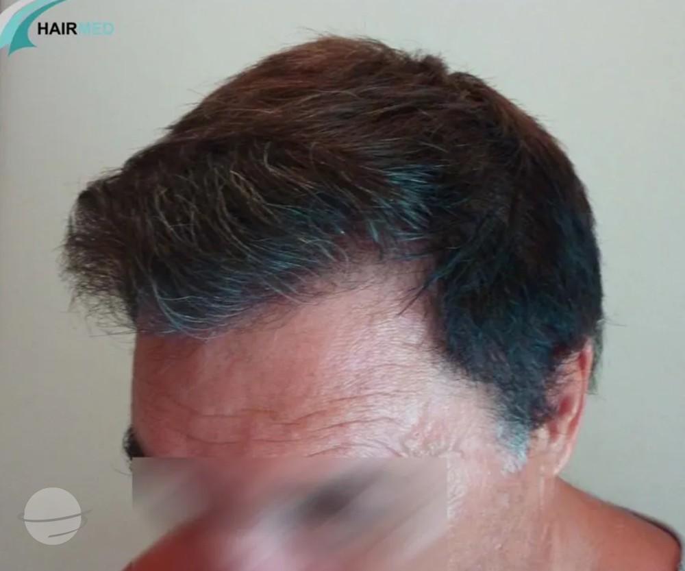 3800 FUE DR BEYHAN FRONT VIEW2