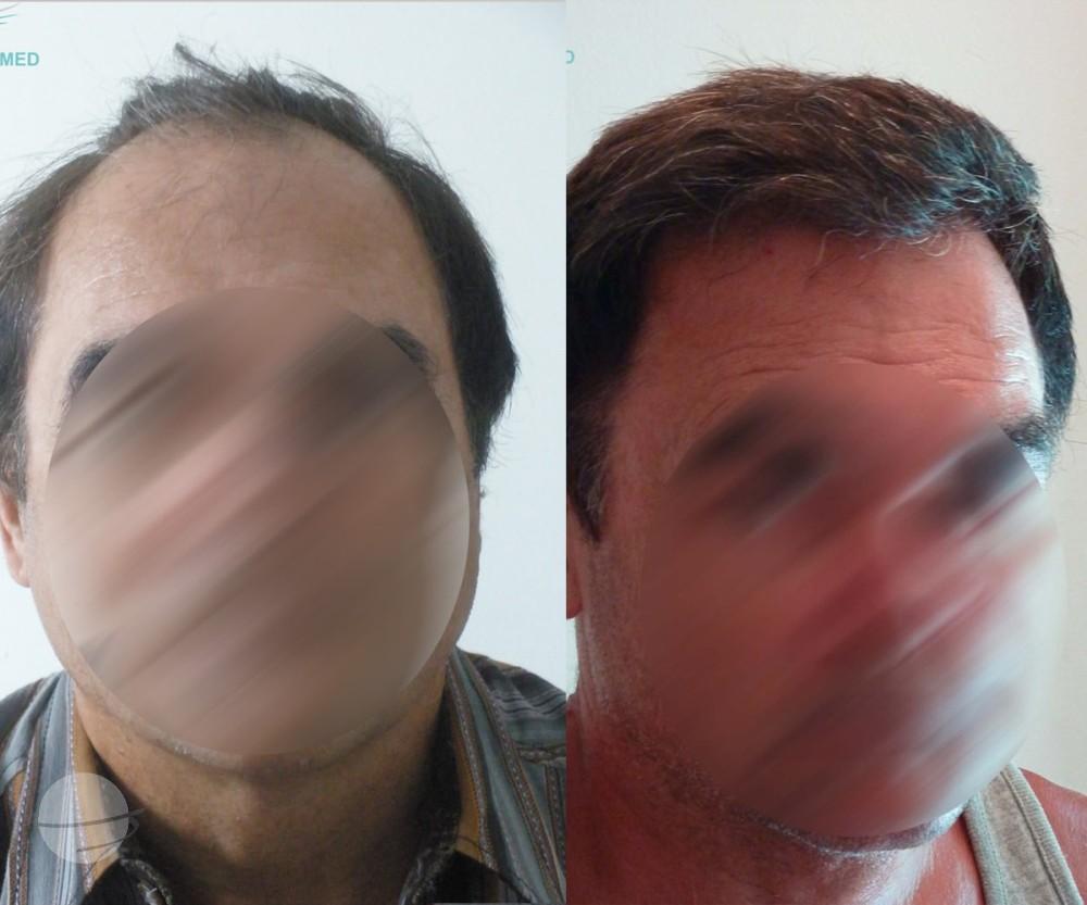 3800 FUE DR BEYHAN FRONT VIEW