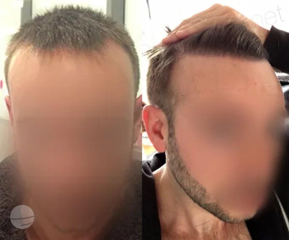 3000 FUE DR BEYHAN FRONT VIEW_