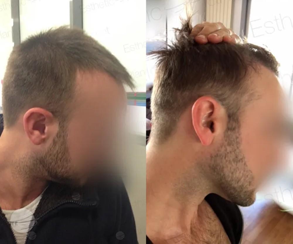 3000 FUE DR BEYHAN side VIEW 2