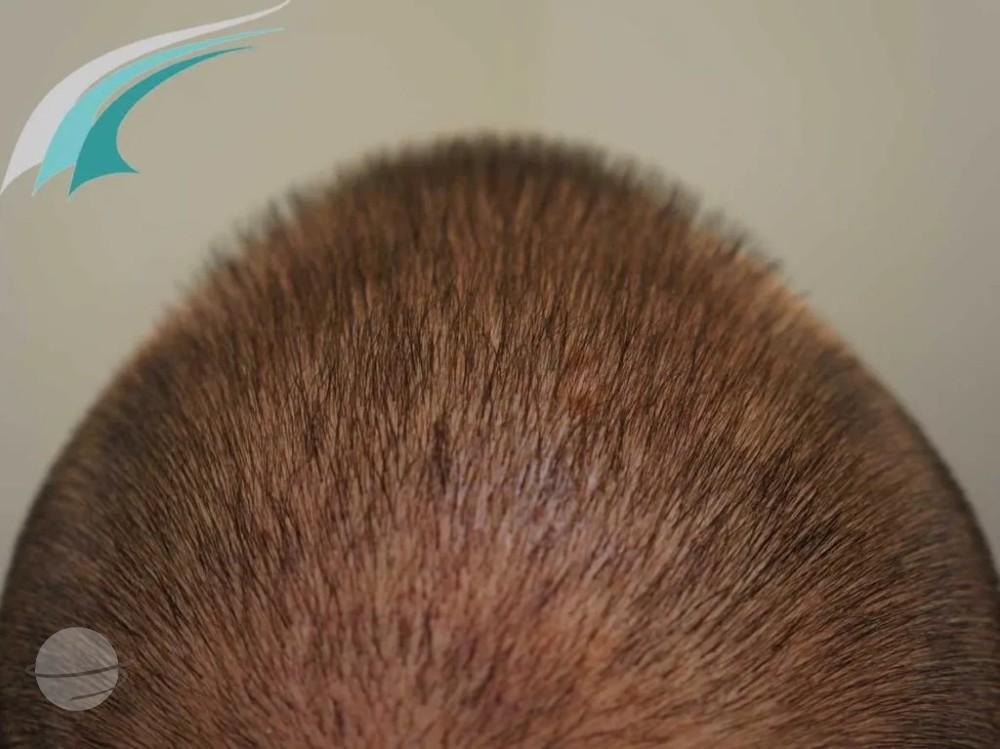 Apres-fue-istanbul-dr-beyhan-hairmed-vue-haut-1024x767