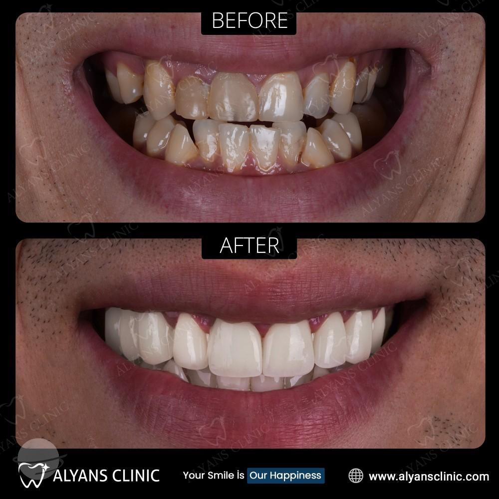 BEFORE=AFTER POST 2-min