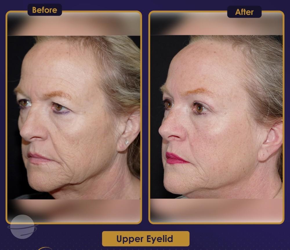 Résultat Estherian8