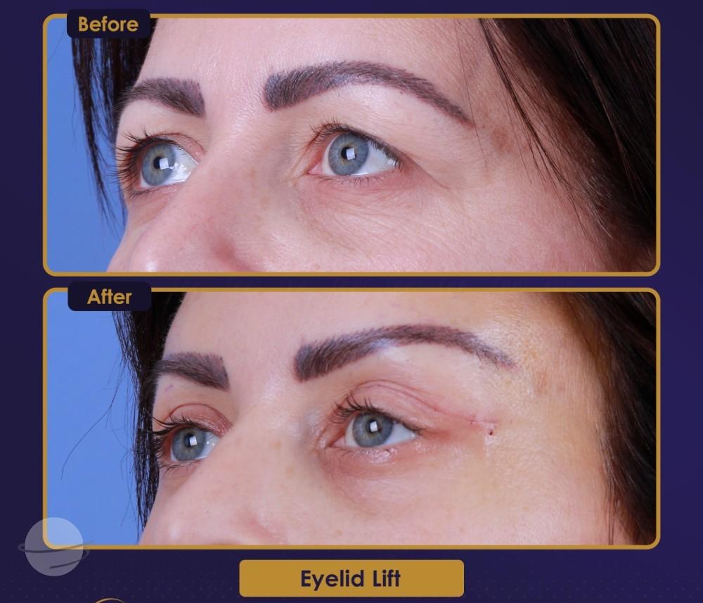 Résultat Estherian9