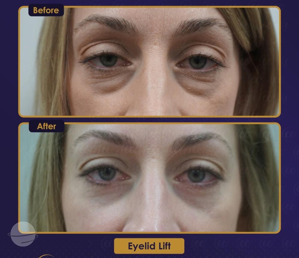 Résultat Estherian12