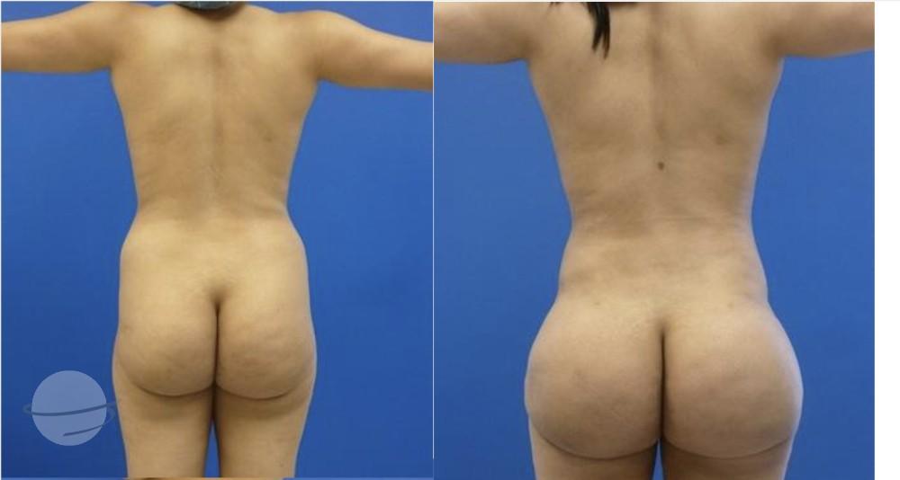 Results BBL by Dr Miklos Molnar