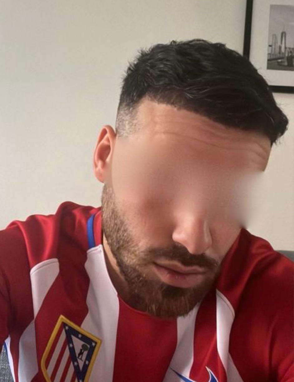 Dr Sofiene Ouerghi before : after9