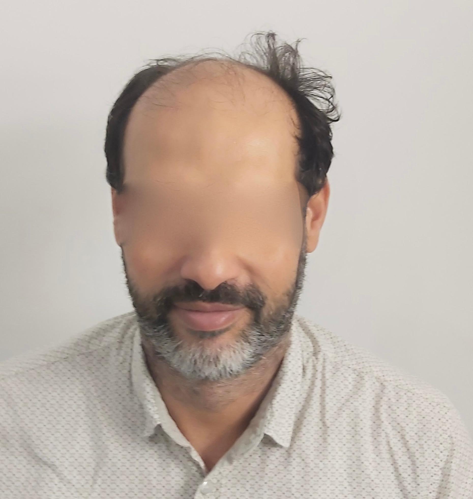 Dr Sofiene Ouerghi before : after6