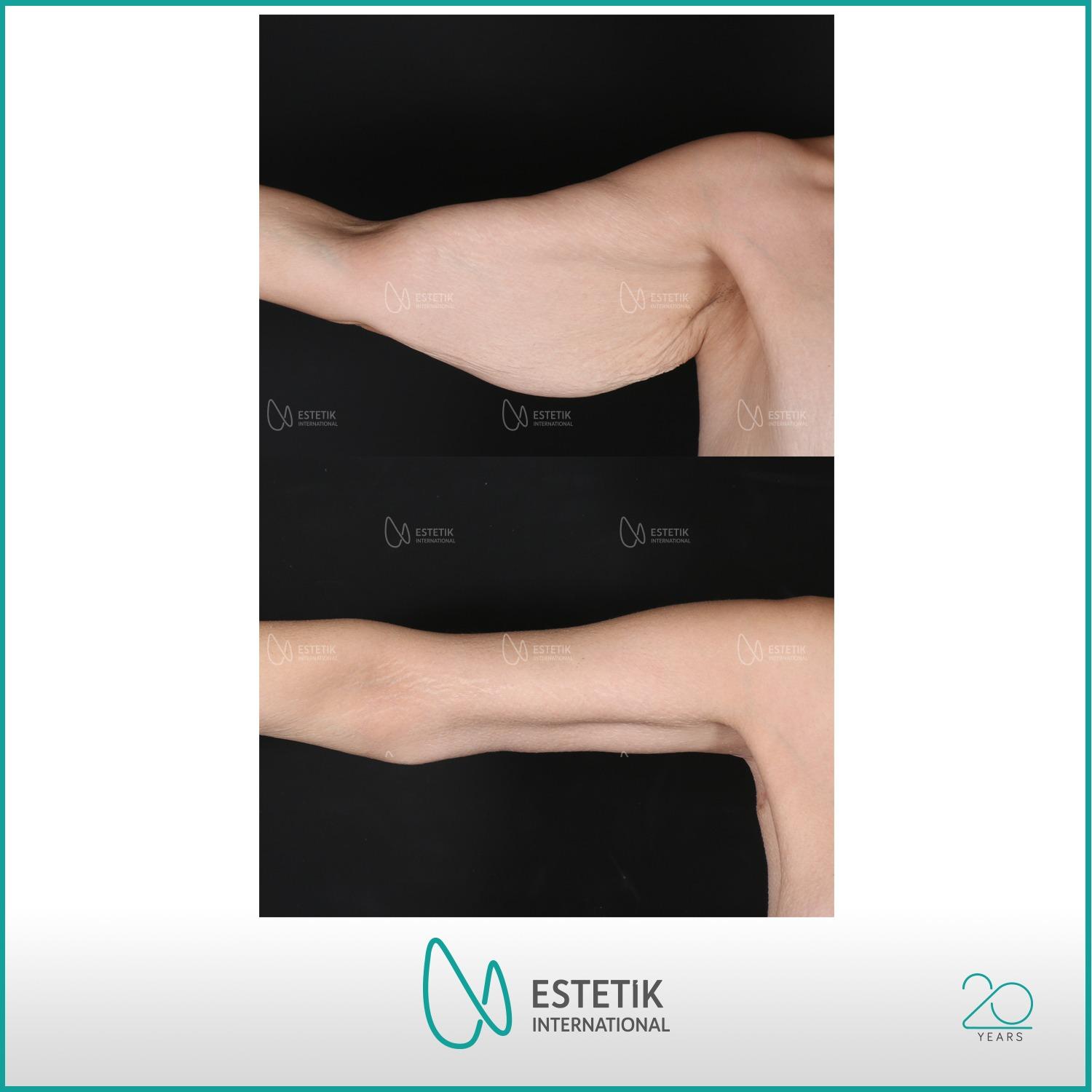 Estetik international results73