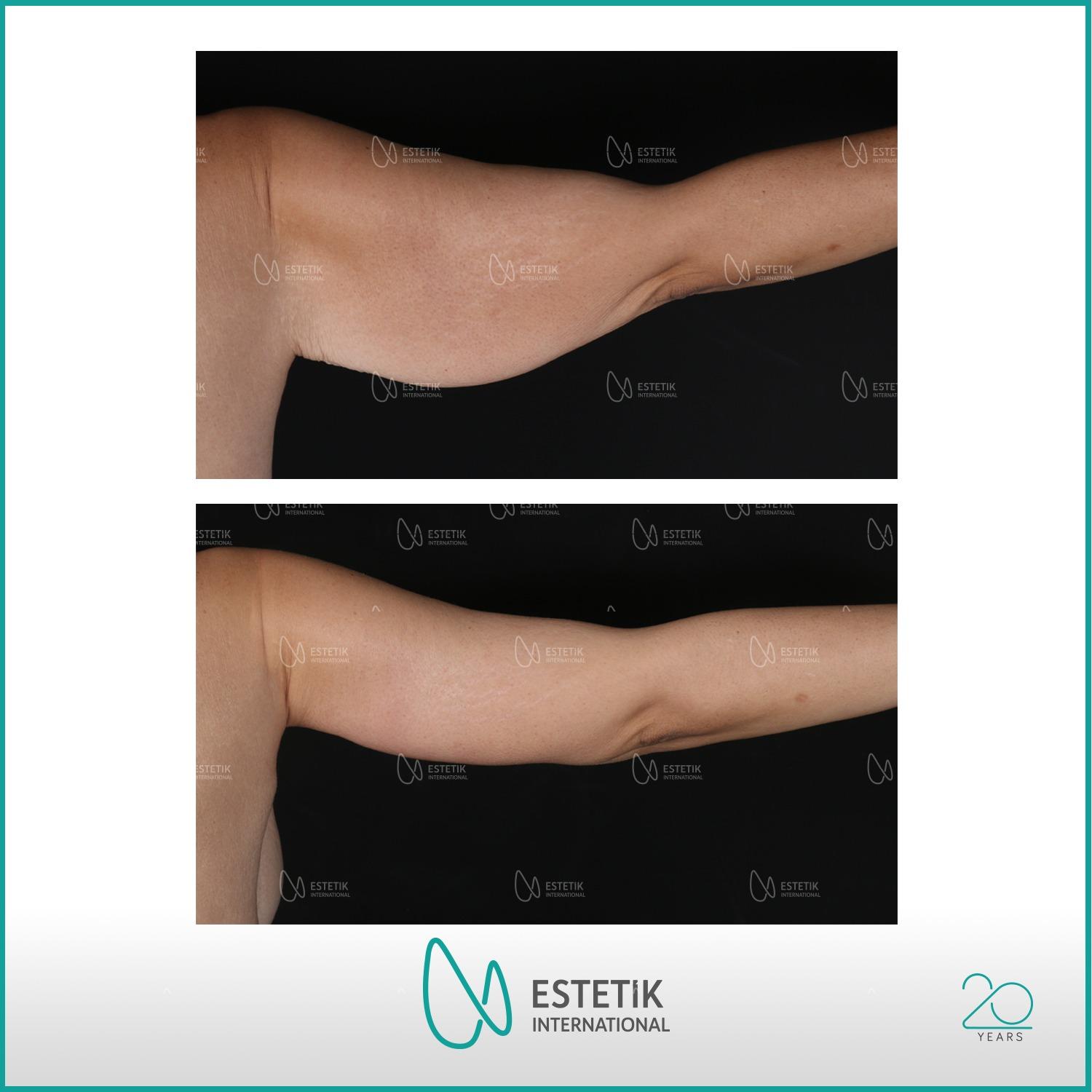 Estetik international results31