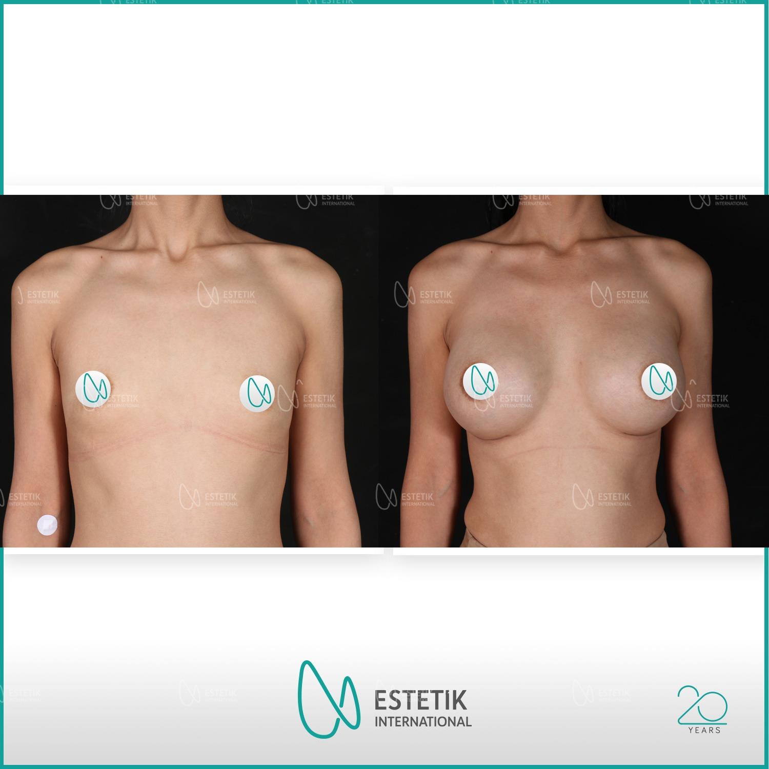 Estetik international results42