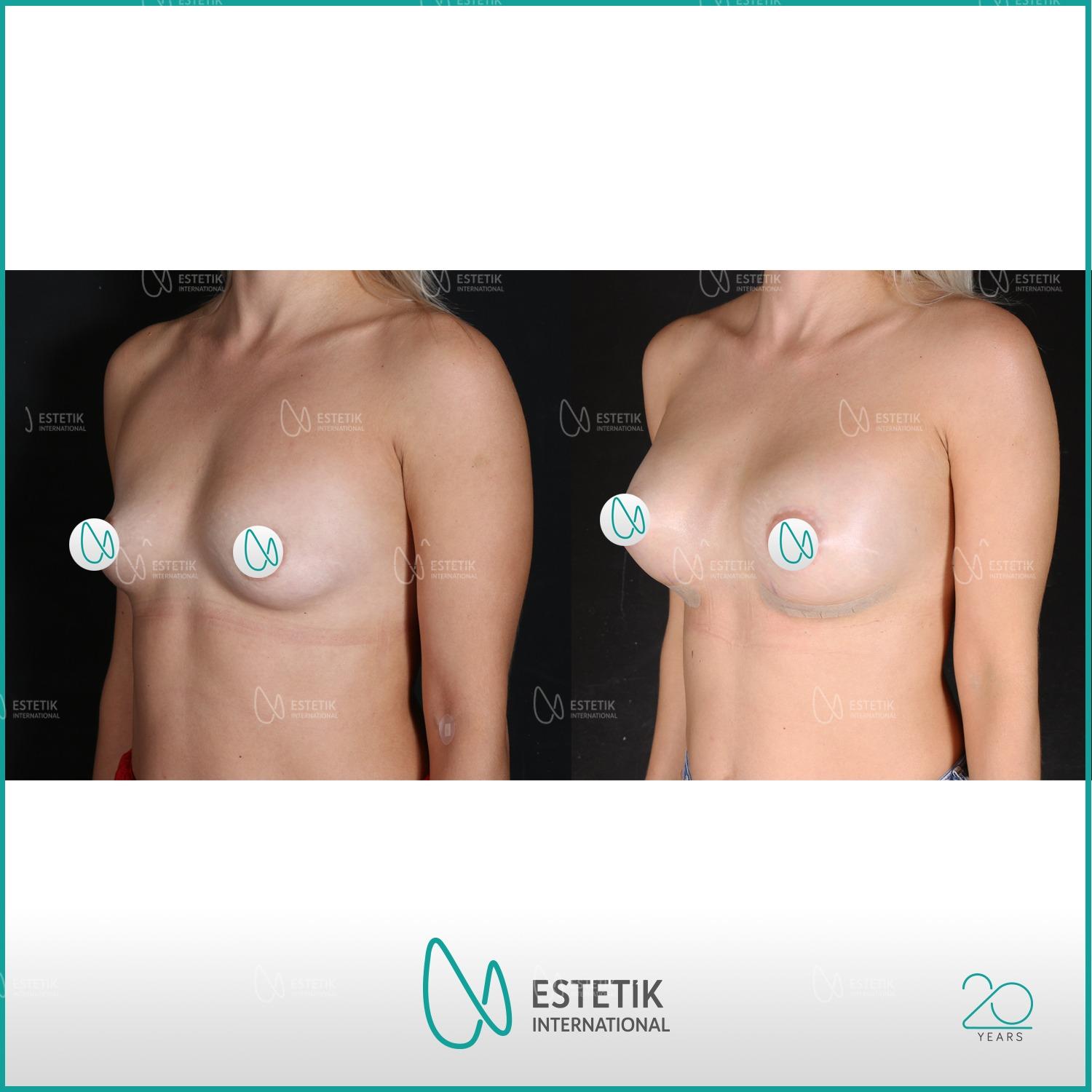 Estetik international results46