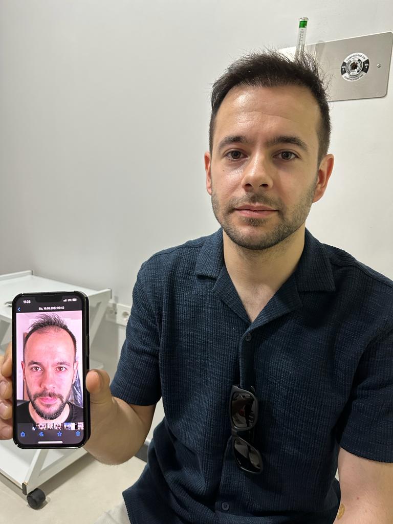 Hope Hair Health Resultats