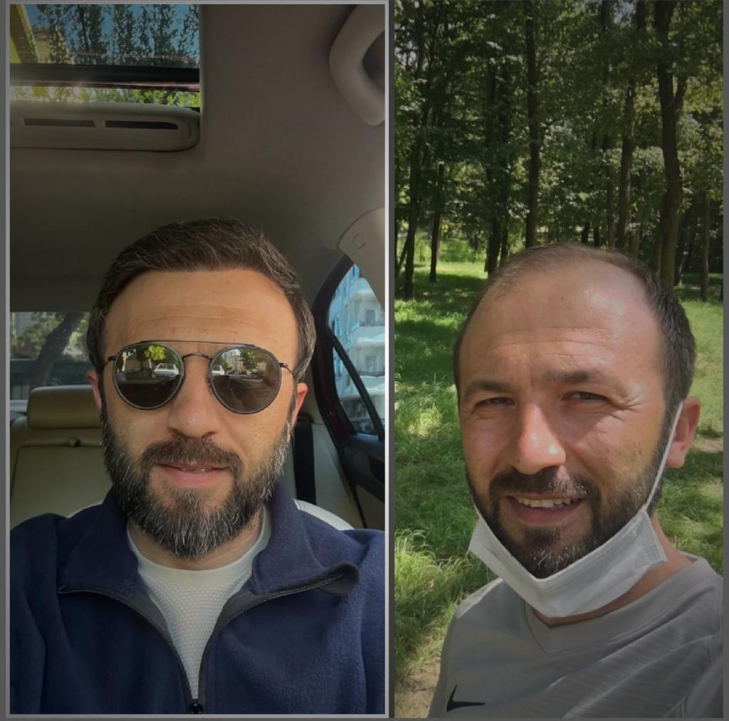 Hope Hair Health Resultats