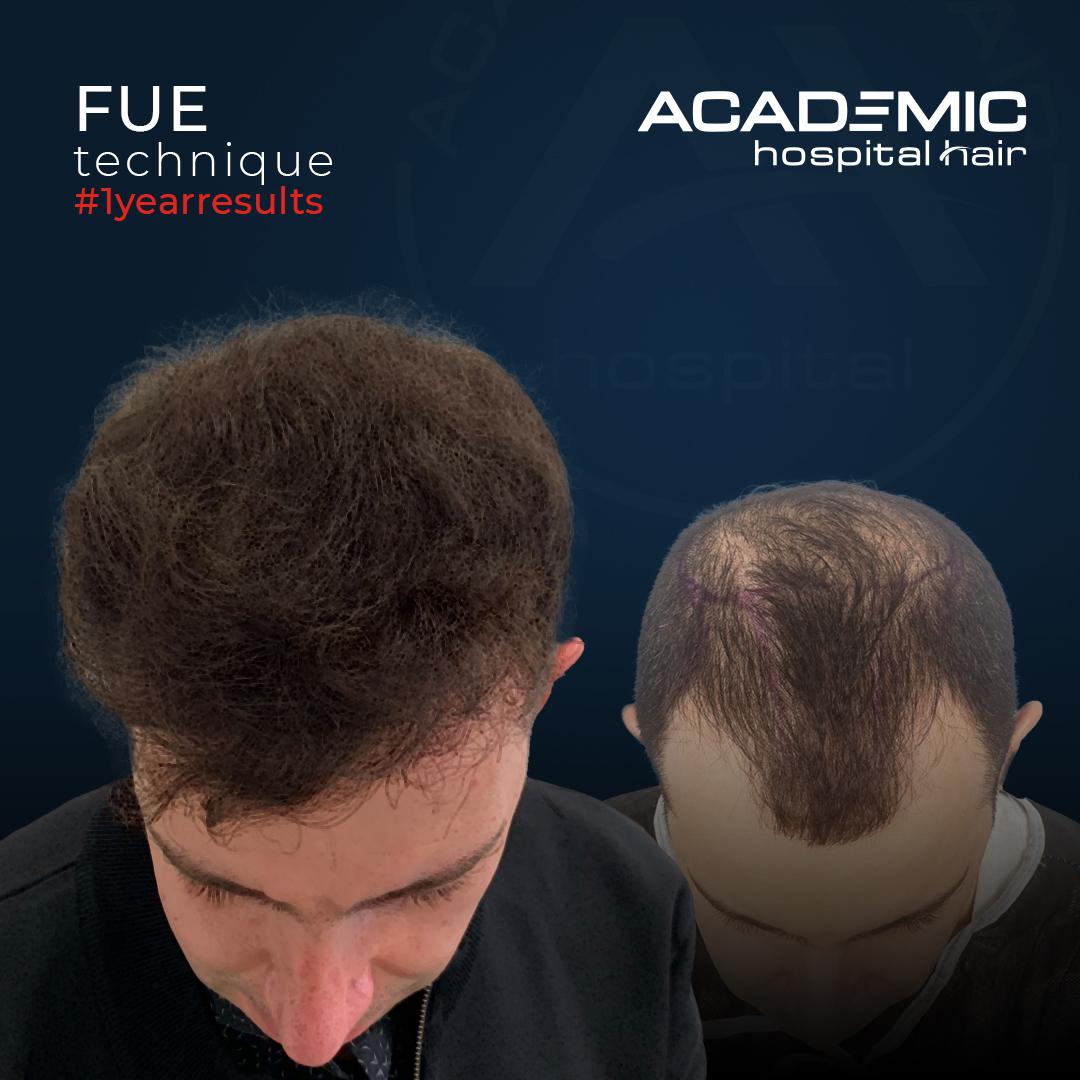 ILTER SEDELE_B-A_KOYU