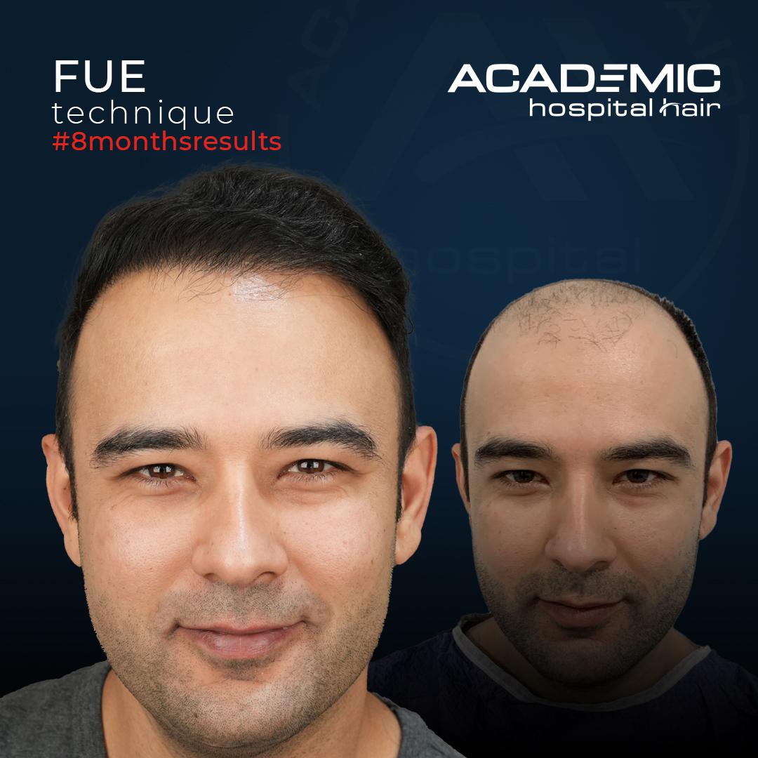 Mustafa Ugur_B-A_KOYU