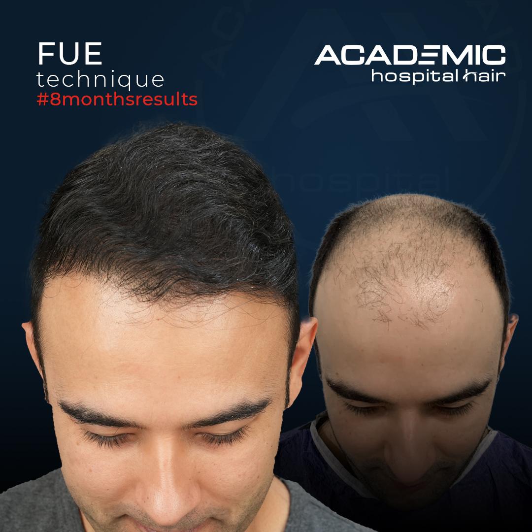 Mustafa Ugur-2_B-A_KOYU