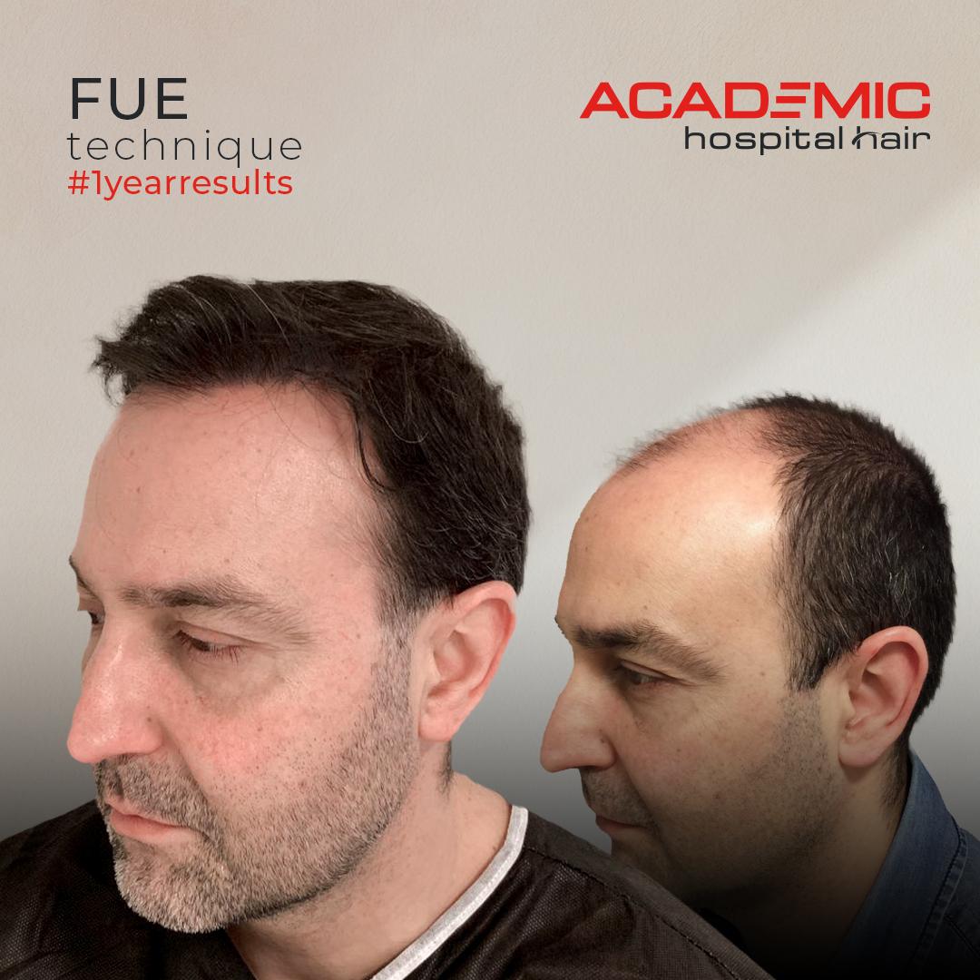 MİGUEL ANGEL SANZ HERNANDEZ_ACIK-2