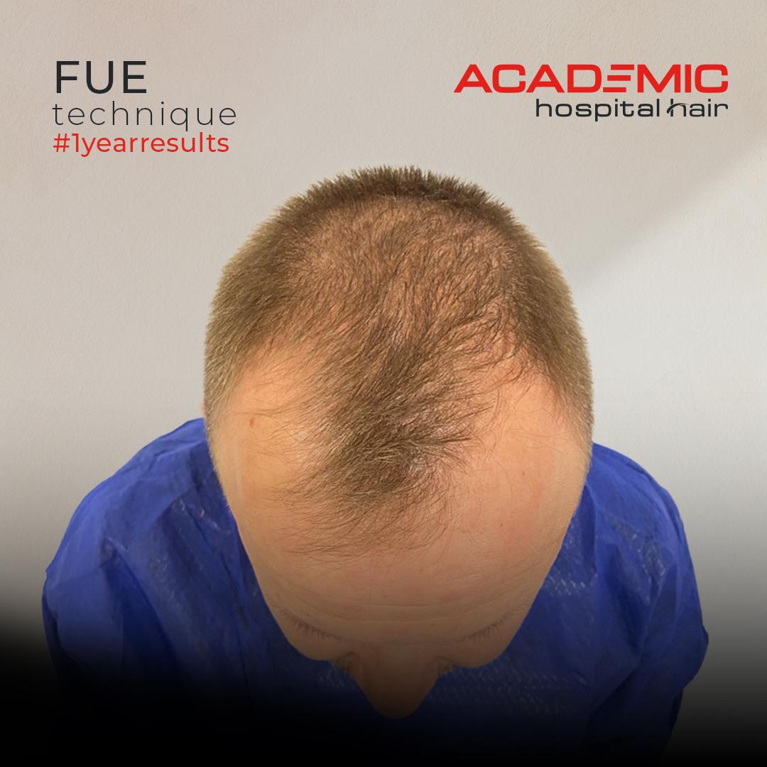 Eugen Koch_DHI_B-A-3