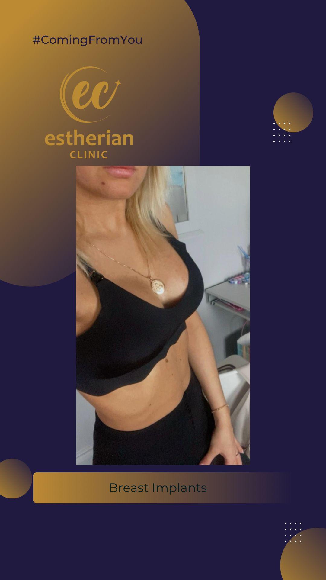 estherian Breast Surgery 6