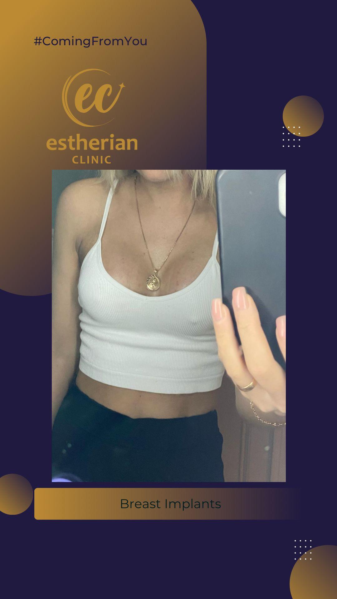 estherian Breast Surgery 7