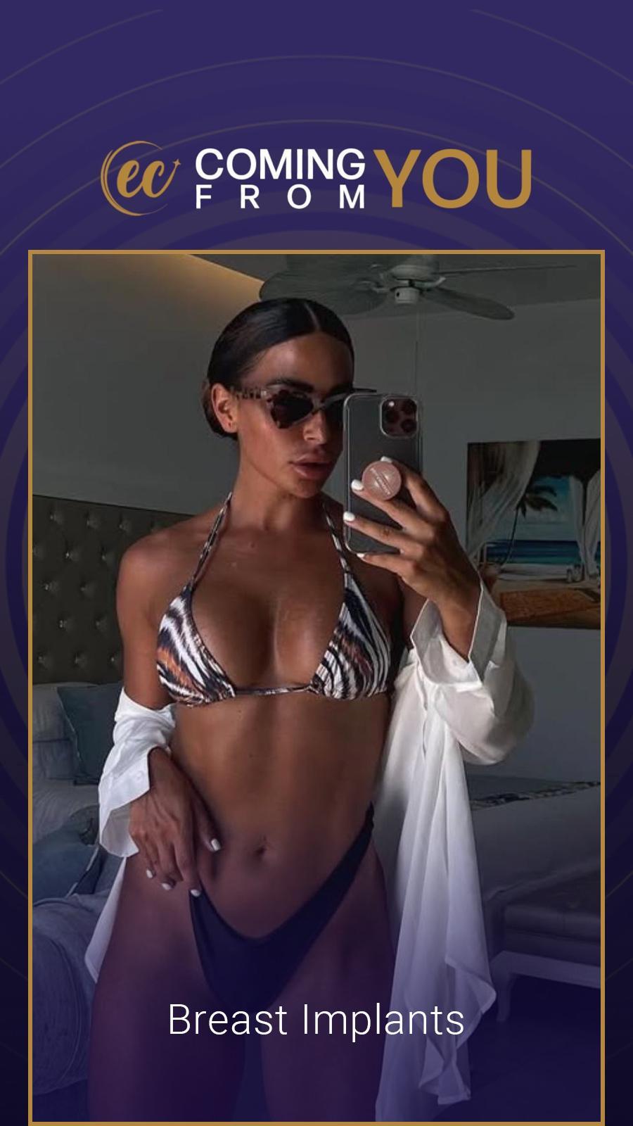 Cosmetic surgery Istanbul Before and after 22