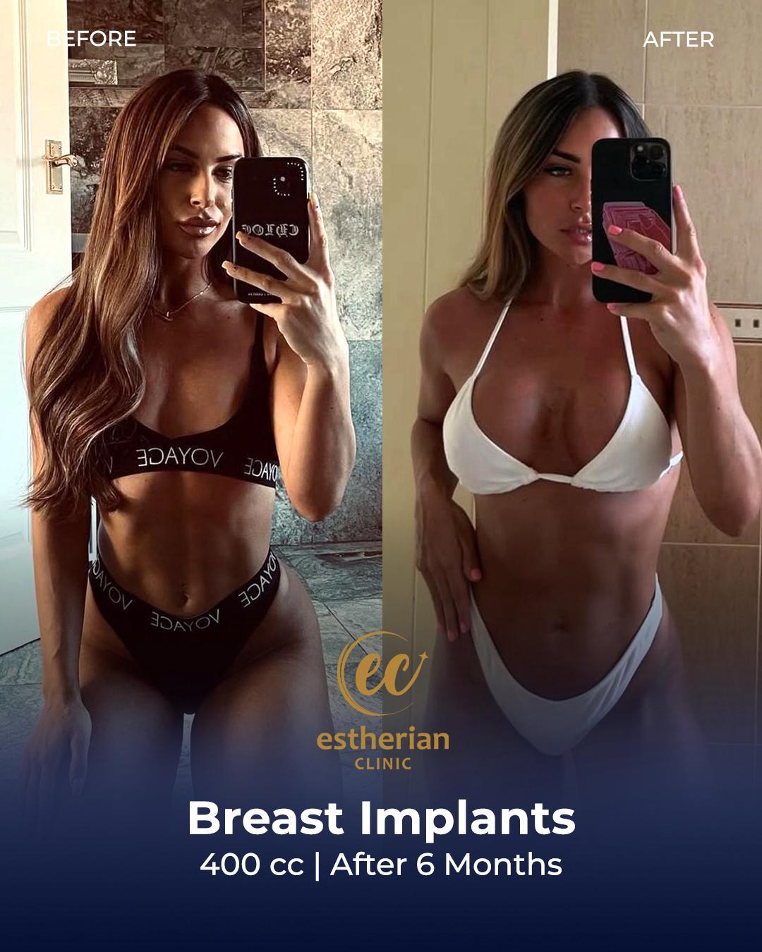 WhatsApp Image 2025-03-10 at 13.51.17