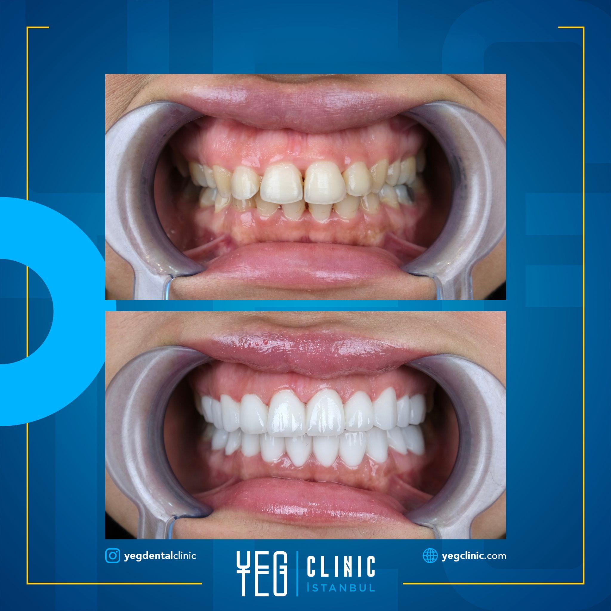 Yeg clinic dental istanbul