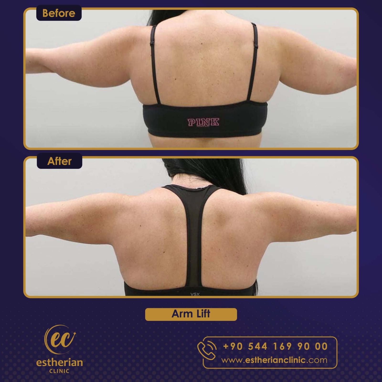 Estherian Istanbul on Esthetic Planet