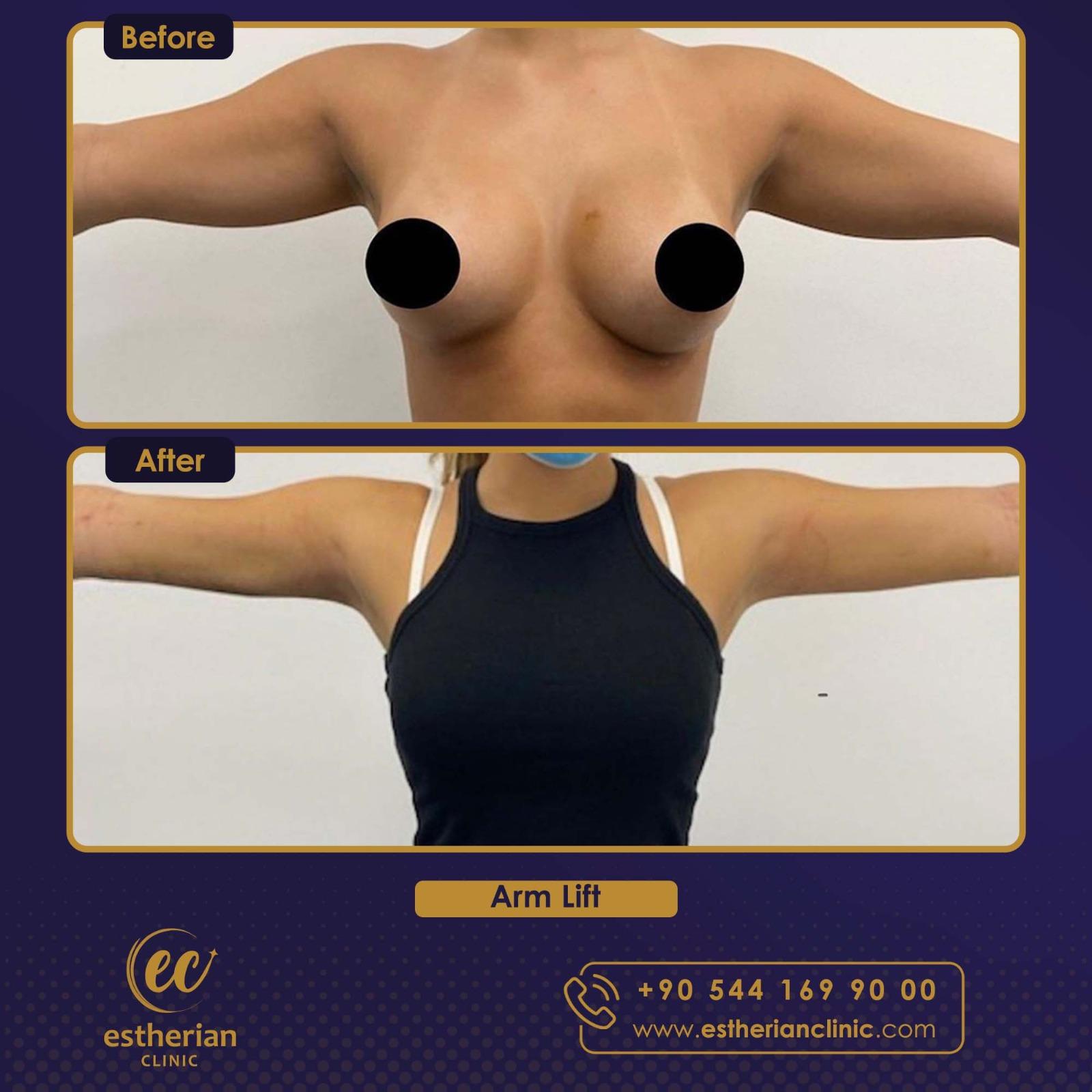 Estherian Istanbul on Esthetic Planet