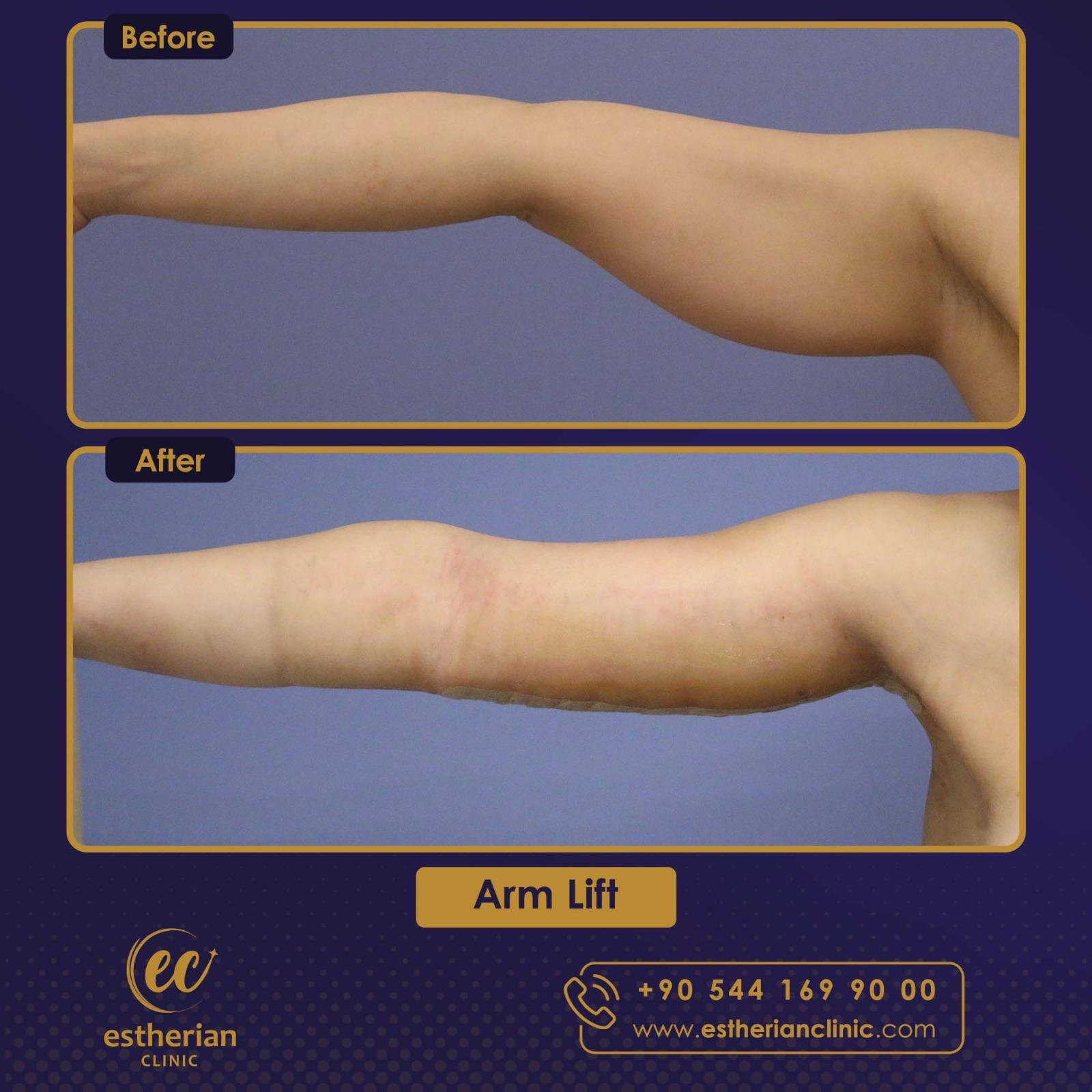 Estherian Istanbul on Esthetic Planet