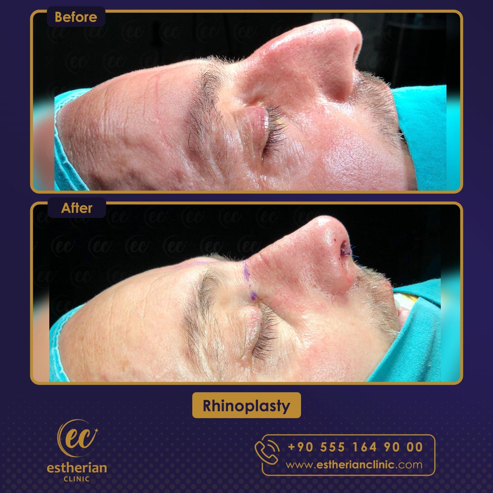 Estherian Istanbul on Esthetic Planet