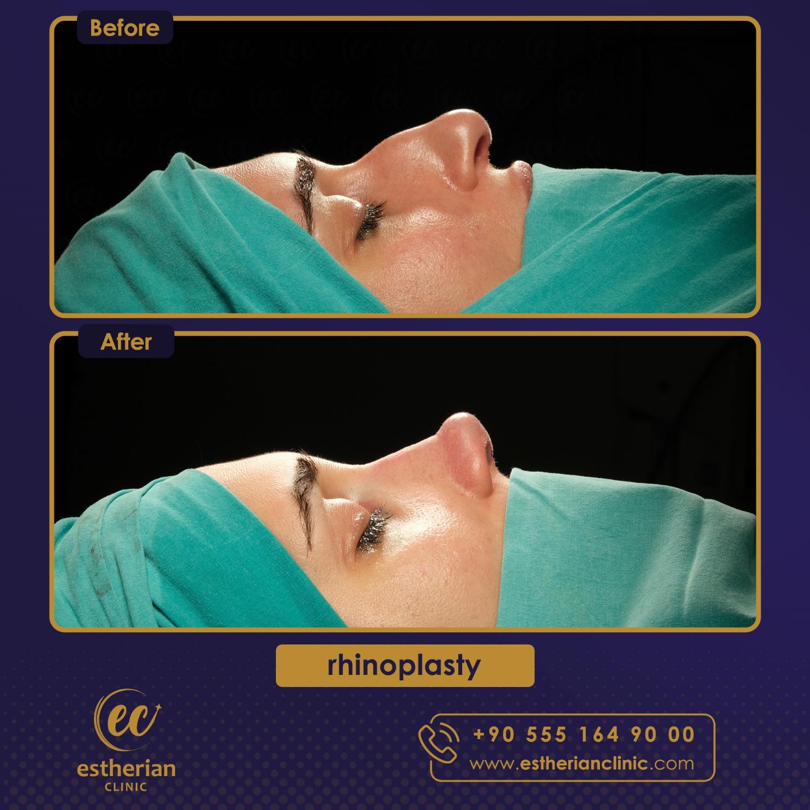 Estherian Istanbul on Esthetic Planet