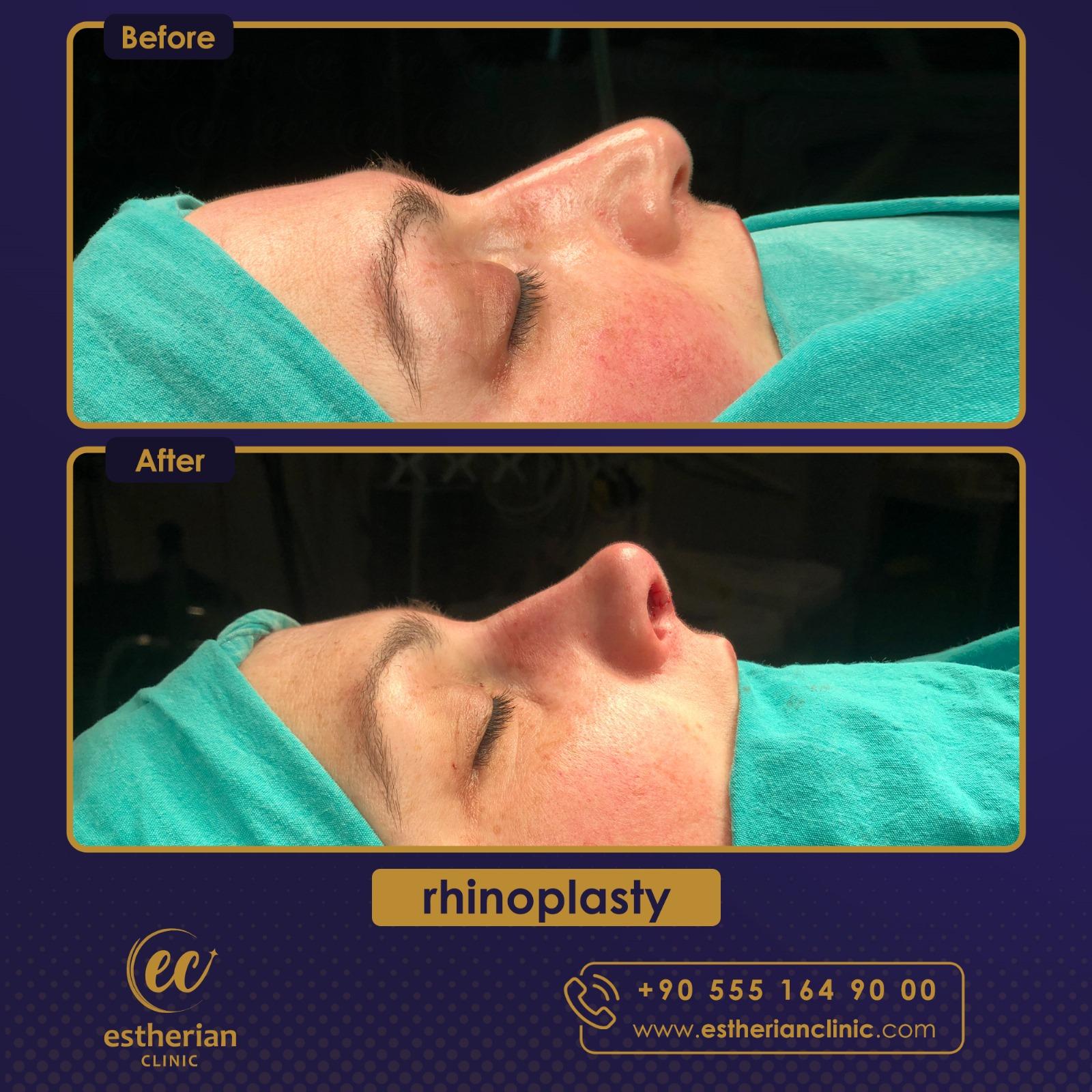 Estherian Istanbul on Esthetic Planet