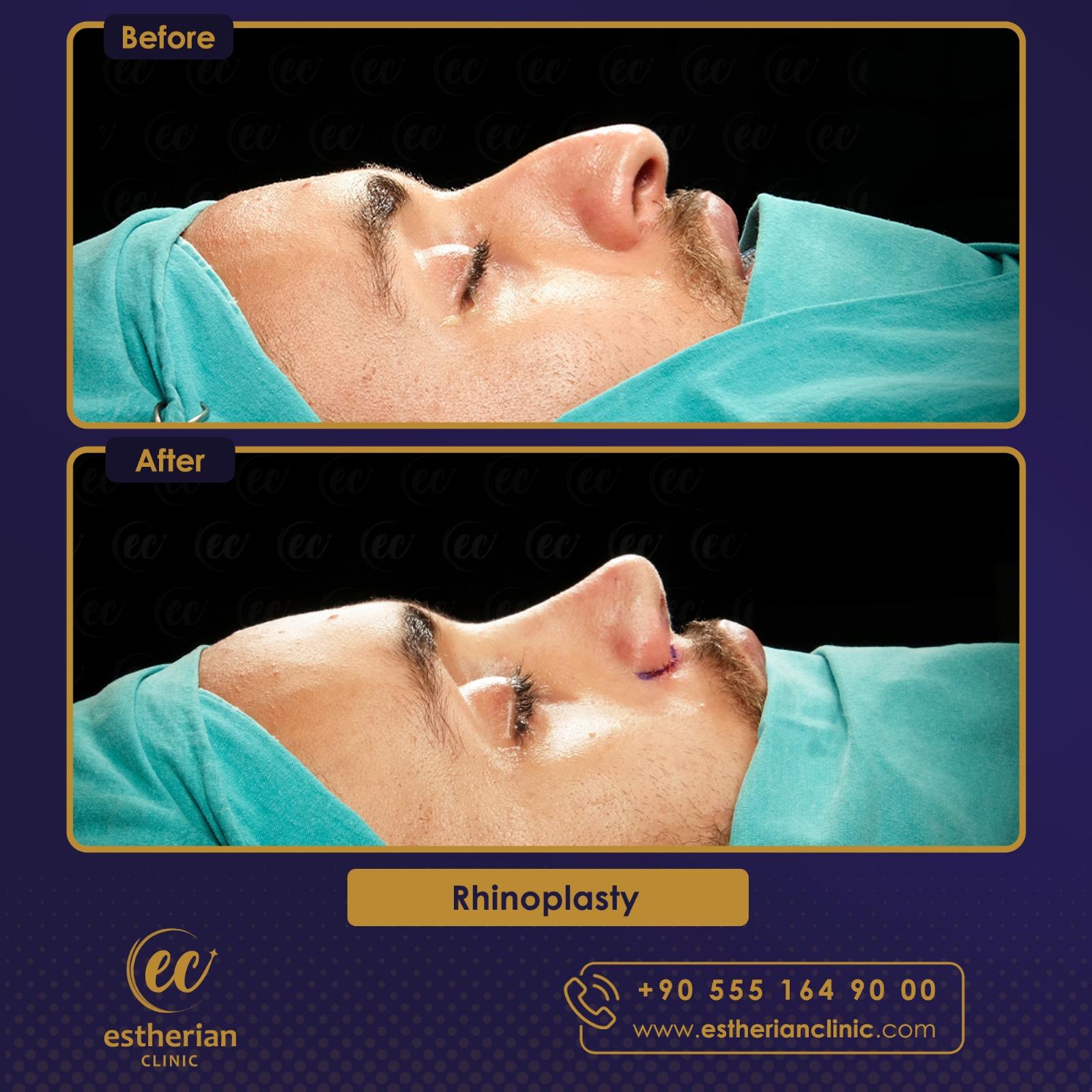 Estherian Istanbul on Esthetic Planet